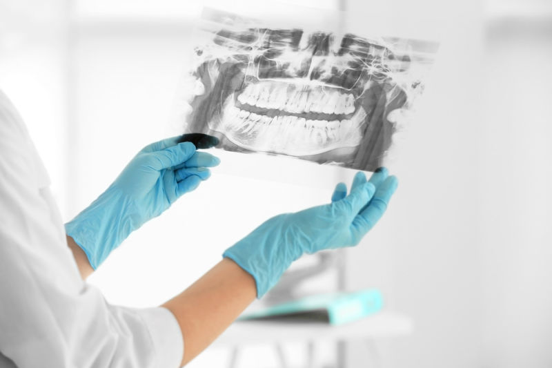 Dentist in westborough with dental X-ray